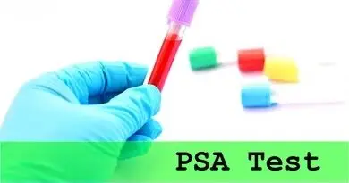 Free Prostate Cancer Testing Event